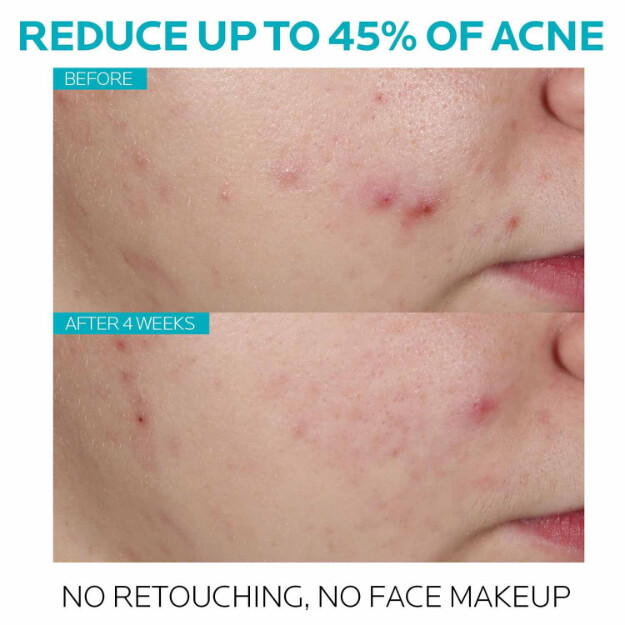 siero per il trattamento dellacne con acido salicilico effaclar siero per il trattamento dellacne con acido salicilico al 15